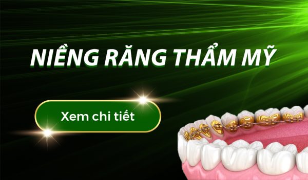 Niềng Răng Mắc Cài