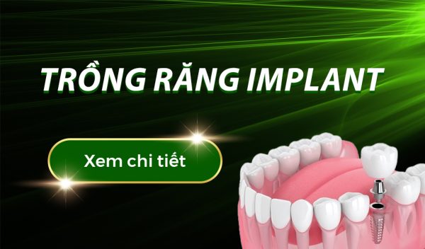 trồng răng implant