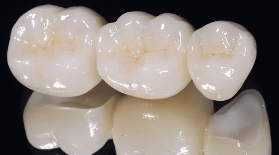 Răng Sứ Zirconia Cho Người Cao Tuổi