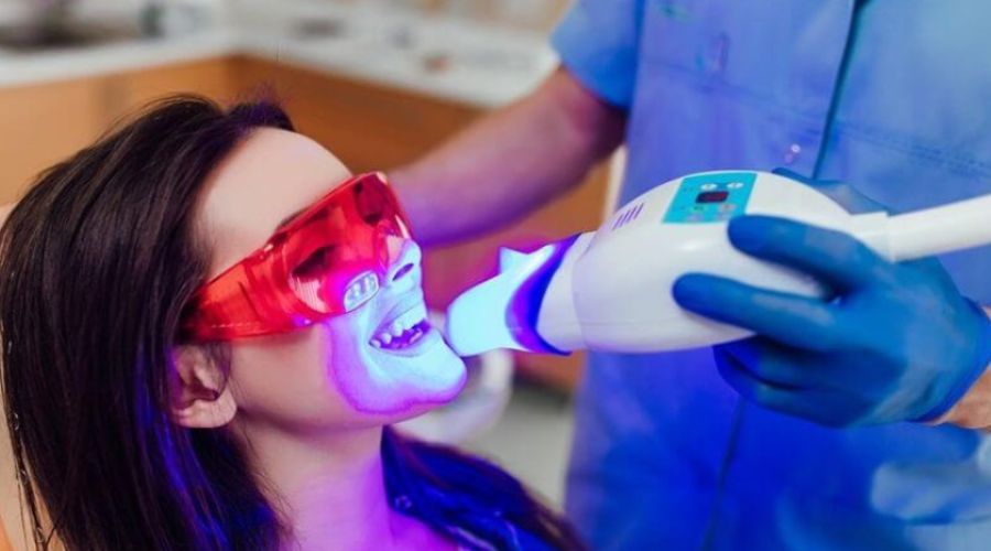 Tẩy Trắng Răng Bằng Laser Là Gì