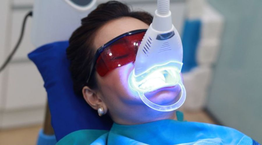 Tính An Toàn Của Tẩy Trắng Răng Bằng Laser